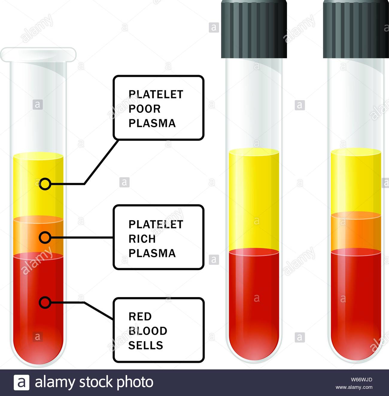 PRP treatment.jpg